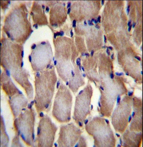 SEPN1 Antibody immunohistochemistry of formalin-fixed and paraffin-embedded human skeletal muscle followed by peroxidase-conjugated secondary antibody and DAB staining.