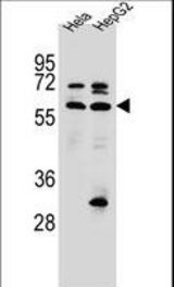 SEPN1 Antibody western blot of HeLa,HepG2 cell line lysates (35 ug/lane). The SEPN1 antibody detected the SEPN1 protein (arrow).