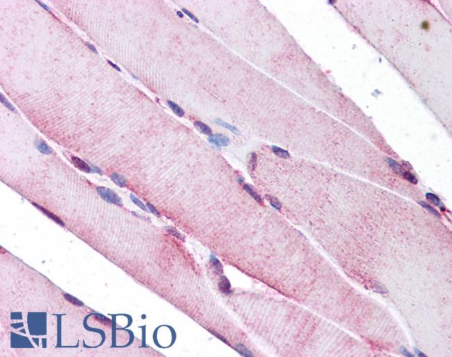 Anti-SEPN1 antibody IHC of human skeletal muscle. Immunohistochemistry of formalin-fixed, paraffin-embedded tissue after heat-induced antigen retrieval. Antibody LS-B4667 concentration 5 ug/ml.