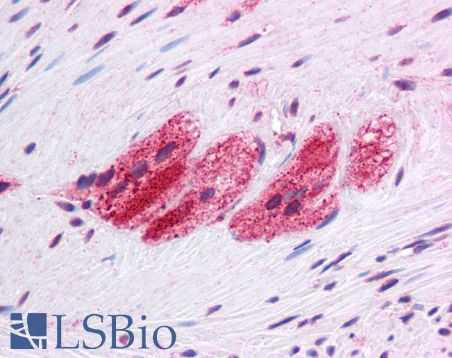 Anti-SEPN1 antibody IHC of human colon, myenteric plexus. Immunohistochemistry of formalin-fixed, paraffin-embedded tissue after heat-induced antigen retrieval. Antibody LS-B4667 concentration 5 ug/ml.