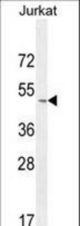 SELPLG Antibody western blot of Jurkat cell line lysates (35 ug/lane). The SELPLG antibody detected the SELPLG protein (arrow).