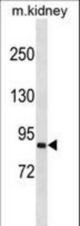 SEMA4A Antibody western blot of mouse kidney tissue lysates (35 ug/lane). The SEMA4A antibody detected the SEMA4A protein (arrow).