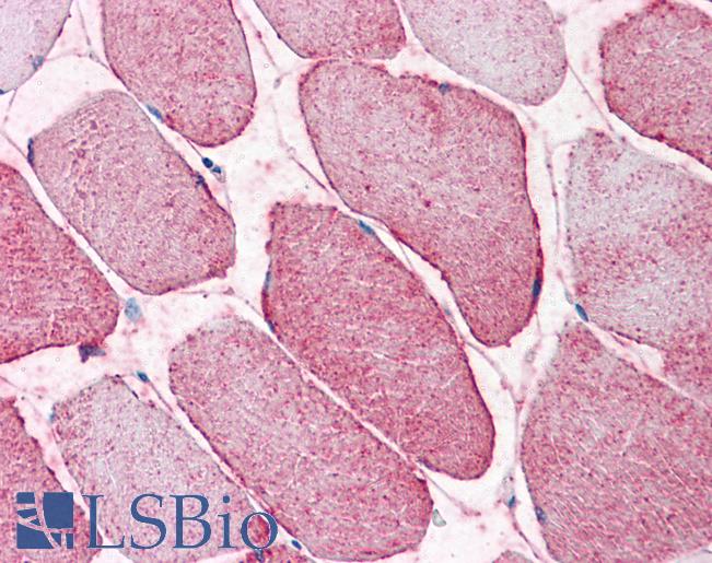 Anti-SEMA4B antibody LS-A9033 IHC of human skeletal muscle. Immunohistochemistry of formalin-fixed, paraffin-embedded tissue after heat-induced antigen retrieval.