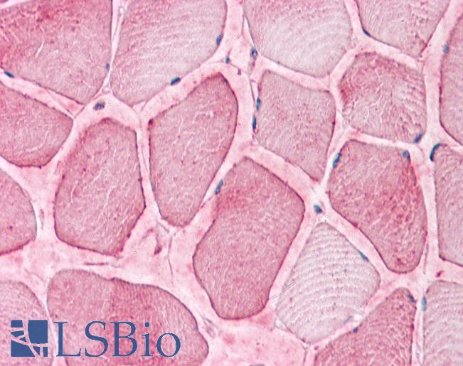 Anti-SEMA4B antibody LS-A9040 IHC of human skeletal muscle. Immunohistochemistry of formalin-fixed, paraffin-embedded tissue after heat-induced antigen retrieval.