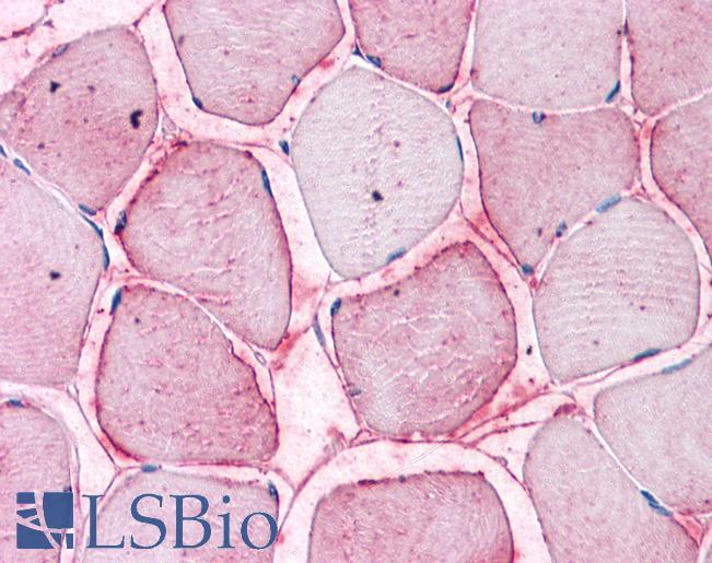 Anti-SEMA4B antibody LS-A9041 IHC of human skeletal muscle. Immunohistochemistry of formalin-fixed, paraffin-embedded tissue after heat-induced antigen retrieval.