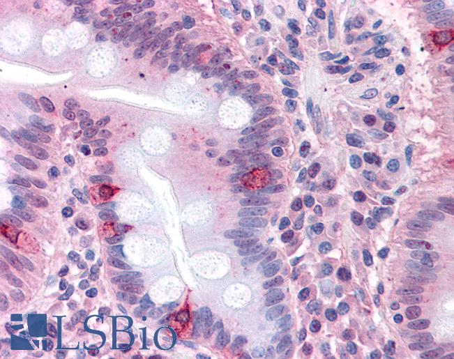 Anti-SEMA4B antibody LS-A9041 IHC of human small intestine. Immunohistochemistry of formalin-fixed, paraffin-embedded tissue after heat-induced antigen retrieval.