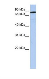 Fetal brain lysate. Antibody concentration: 1.0 ug/ml. Gel concentration: 12%.