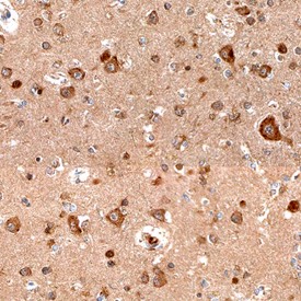 Semaphorin 4C in Human Brain. Semaphorin 4C was detected in immersion fixed paraffin-embedded sections of human brain (cortex) using Sheep Anti-Human Semaphorin 4C Antigen Affinity-purified Polyclonal Antibody at 15 ug/ml overnight at 4°C. Before incubation with the primary antibody, tissue was subjected to heat-induced epitope retrieval using Antigen Retrieval Reagent-Basic. Tissue was stained using Anti-Sheep HRP-DAB (brown) and counterstained with hematoxylin (blue). Specific staining was localized to neuronal cell bodies.