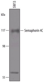 Detection of Human Semaphorin 4C by Western Blot. Western blot shows lysates of SW13 human adrenal cortex adenocarcinoma cell line. PVDF membrane was probed with 0.5 ug/ml of Sheep Anti-Human Semaphorin 4C Antigen Affinity-purified Polyclonal Antibody followed by HRP-conjugated Anti-Sheep IgG Secondary Antibody. A specific band was detected for Semaphorin 4C at approximately 110 kD (as indicated). This experiment was conducted under reducing conditions.