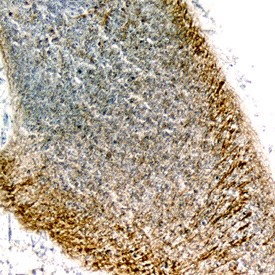 Semaphorin 4C in Mouse Embryo. Semaphorin 4C was detected in perfusion fixed frozen sections of mouse embryo (13 d. p. c.) using Sheep Anti-Mouse Semaphorin 4C Antigen Affinity-purified Polyclonal Antibody at 1.7 ug/ml overnight at 4°C. Tissue was stained using Anti-Sheep HRP-DAB (brown) and counterstained with hematoxylin (blue). Specific staining was localized to neuronal processes of the developing cerebellum.