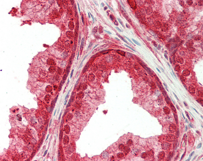 Human Prostate: Formalin-Fixed, Paraffin-Embedded (FFPE)