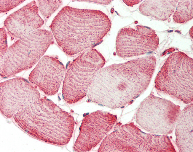 Human Skeletal Muscle: Formalin-Fixed, Paraffin-Embedded (FFPE)