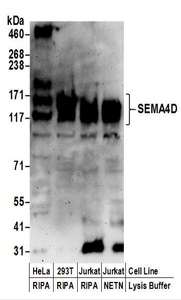 Detection of Human SEMA4D by Western Blot. Samples: Whole cell lysate (50 ug) prepared using NETN or RIPA buffer from HeLa, 293T, and Jurkat cells. Antibodies: Affinity purified rabbit anti-SEMA4D antibody used for WB at 0.1 ug/ml. Detection: Chemiluminescence with an exposure time of 3 minutes.