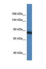 SEMA4D / CD100 antibody LS-C145465 Western blot of HeLa Cell lysate. Antibody concentration 1 ug/ml.