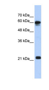 SEMA4F antibody LS-C111097 Western blot of Transfected 293T cell lysate.