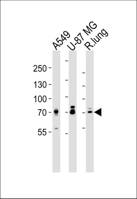 Western blot of lysates from A549, U-87 MG cell line and rat lung tissue lysate (from left to right) with SEMA4F Antibody. Antibody was diluted at 1:1000 at each lane. A goat anti-rabbit IgG H&L (HRP) at 1:5000 dilution was used as the secondary antibody. Lysates at 35 ug per lane.