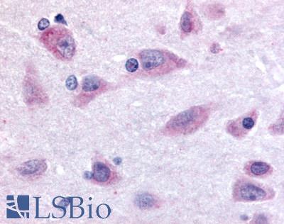 Anti-PROKR2 antibody LS-A3148 IHC of human brain, neurons and glia. Immunohistochemistry of formalin-fixed, paraffin-embedded tissue after heat-induced antigen retrieval.