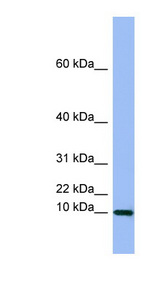 SEMG1 antibody LS-C107556 Western blot of COLO205 cell lysate.