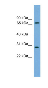 SEMG2 antibody LS-C117049 Western blot of COLO205 cell lysate.