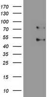 HEK293T cells were transfected with the pCMV6-ENTRY control (Left lane) or pCMV6-ENTRY SENP1 (Right lane) cDNA for 48 hrs and lysed. Equivalent amounts of cell lysates (5 ug per lane) were separated by SDS-PAGE and immunoblotted with anti-SENP1.