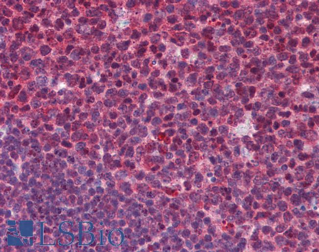 Anti-SENP1 antibody IHC of human tonsil. Immunohistochemistry of formalin-fixed, paraffin-embedded tissue after heat-induced antigen retrieval. Antibody LS-B5861 concentration 5 ug/ml.