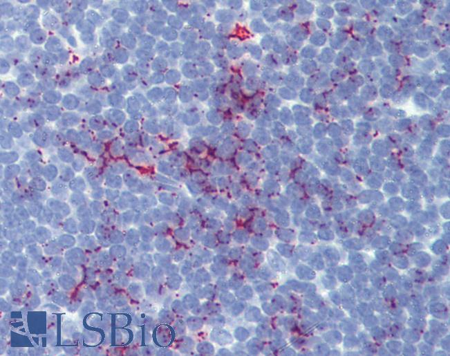 Anti-SENP1 antibody IHC of human thymus. Immunohistochemistry of formalin-fixed, paraffin-embedded tissue after heat-induced antigen retrieval. Antibody LS-B3387 concentration 10 ug/ml.