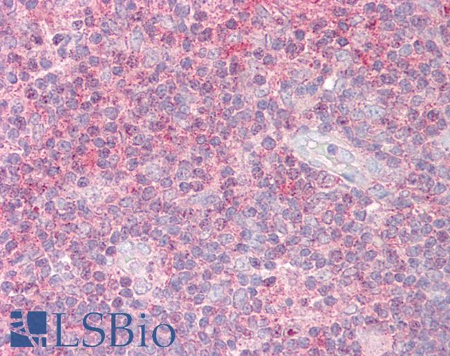 Anti-SENP1 antibody IHC of human thymus. Immunohistochemistry of formalin-fixed, paraffin-embedded tissue after heat-induced antigen retrieval. Antibody LS-B7649 concentration 10 ug/ml.