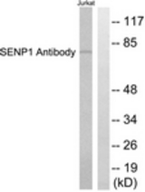 Western blot of extracts from Jurkat cells, using SENP1 Antibody. The lane on the right is treated with the synthesized peptide.