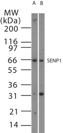 Western blot of SENP1 in 15 ugs of (A) Jurkat and (B) NIH3T3 cell lysate using antibody at 1:1000.