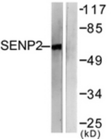 Western blot of extracts from MDA-MB-435 cells, using SENP2 Antibody. The lane on the right is treated with the synthesized peptide.
