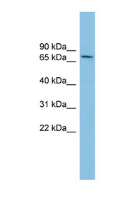 SENP2 antibody LS-C116689 Western blot of COLO205 cell lysate.