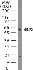 Western blot of SENP2 in 15 ugs of Jurkat cell lysate using antibody at 1:1000.