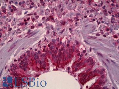Anti-SENP2 antibody IHC of human lung, respiratory epithelium. Immunohistochemistry of formalin-fixed, paraffin-embedded tissue after heat-induced antigen retrieval. Antibody LS-B6656 dilution 1:50.