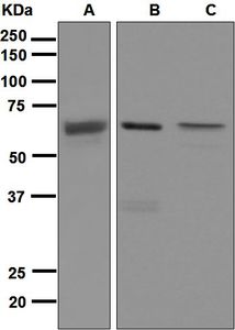 Western blot analysis on (A) MDA-MB-435, (B) NIH: OVCAR-3, and (C) 293T cell lysates using anti-SENP2 antibody.