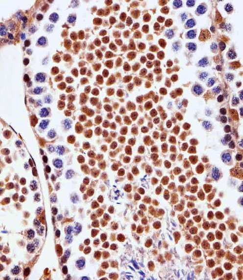 Immunohistochemical of paraffin-embedded M.testis section using PSMD10 Antibody. Antibody was diluted at 1:25 dilution. A peroxidase-conjugated goat anti-rabbit IgG at 1:400 dilution was used as the secondary antibody, followed by DAB staining.