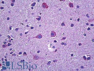 Anti-PROKR2 antibody IHC of human brain, cortex. Immunohistochemistry of formalin-fixed, paraffin-embedded tissue after heat-induced antigen retrieval. Antibody LS-B5918 concentration 3.75 ug/ml.