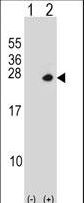 Western blot of PSMD10 (arrow) using rabbit polyclonal PSMD10 Antibody. 293 cell lysates (2 ug/lane) either nontransfected (Lane 1) or transiently transfected (Lane 2) with the PSMD10 gene.