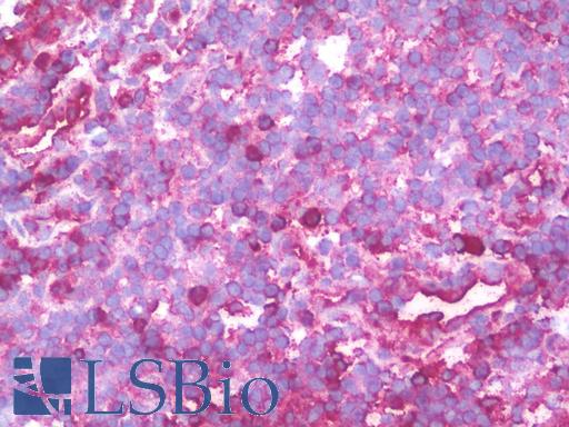 IHC with PSMD10 antibody on frozen human tonsil.