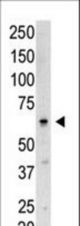 Western blot of SENP3 N-term polyclonal antibody in Saos-2 cell lysate. SENP3 (arrow) was detected using purified antibody. Secondary HRP-anti-rabbit was used for signal visualization with chemiluminescence.