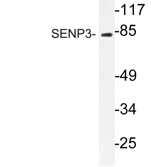 Western blot of SENP3 (Y24) pAb in extracts from Jurkat cells.