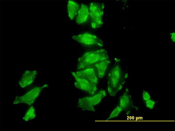 Immunofluorescence of monoclonal antibody to PSMD10 on HeLa cell (antibody concentration 10 ug/ml).