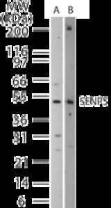 Western blot of SENP5 in 15 ugs of (A) Jurkat and (B) NIH3T3 cell lysate using antibody at 1:500.