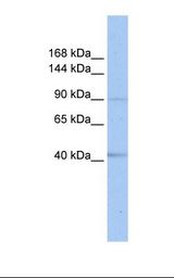 721_B cell lysate. Antibody concentration: 1.0 ug/ml. Gel concentration: 6-18%.