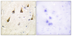 IHC of paraffin-embedded human brain tissue, using SENP7 Antibody. The picture on the right is treated with the synthesized peptide.