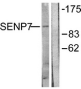 Western blot of extracts from HUVEC cells, using SENP7 Antibody. The lane on the right is treated with the synthesized peptide.
