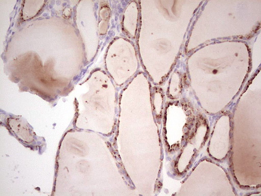 IHC of paraffin-embedded Human thyroid tissue using anti-SENP8 mouse monoclonal antibody. (Heat-induced epitope retrieval by 1 mM EDTA in 10mM Tris, pH8.5, 120°C for 3min).