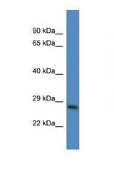 PSMD10 antibody LS-C135385 Western blot of Mouse Liver lysate. Antibody concentration 1 ug/ml.
