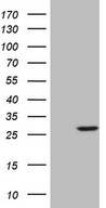 HEK293T cells were transfected with the pCMV6-ENTRY control (Left lane) or pCMV6-ENTRY SENP8 (Right lane) cDNA for 48 hrs and lysed. Equivalent amounts of cell lysates (5 ug per lane) were separated by SDS-PAGE and immunoblotted with anti-SENP8.