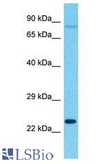 SENP8 antibody Western Blot of 786-0. Antibody dilution: 1 ug/ml.