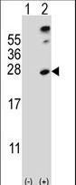 Western blot of SENP8 (arrow) using rabbit polyclonal SENP8 Antibody (S19). 293 cell lysates (2 ug/lane) either nontransfected (Lane 1) or transiently transfected (Lane 2) with the SENP8 gene.